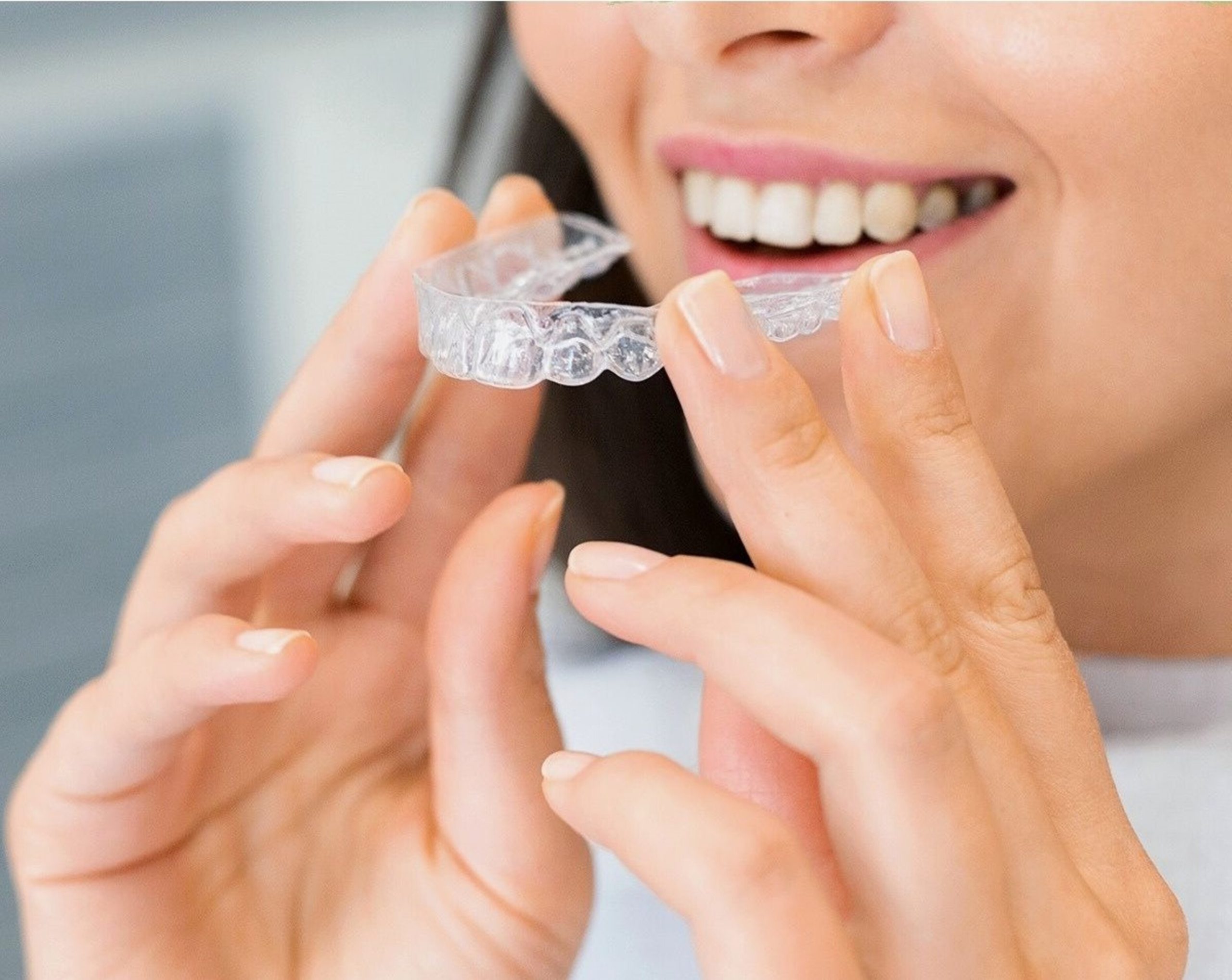 How Clear Aligners Can Improve Your Smile and Boost Confidence