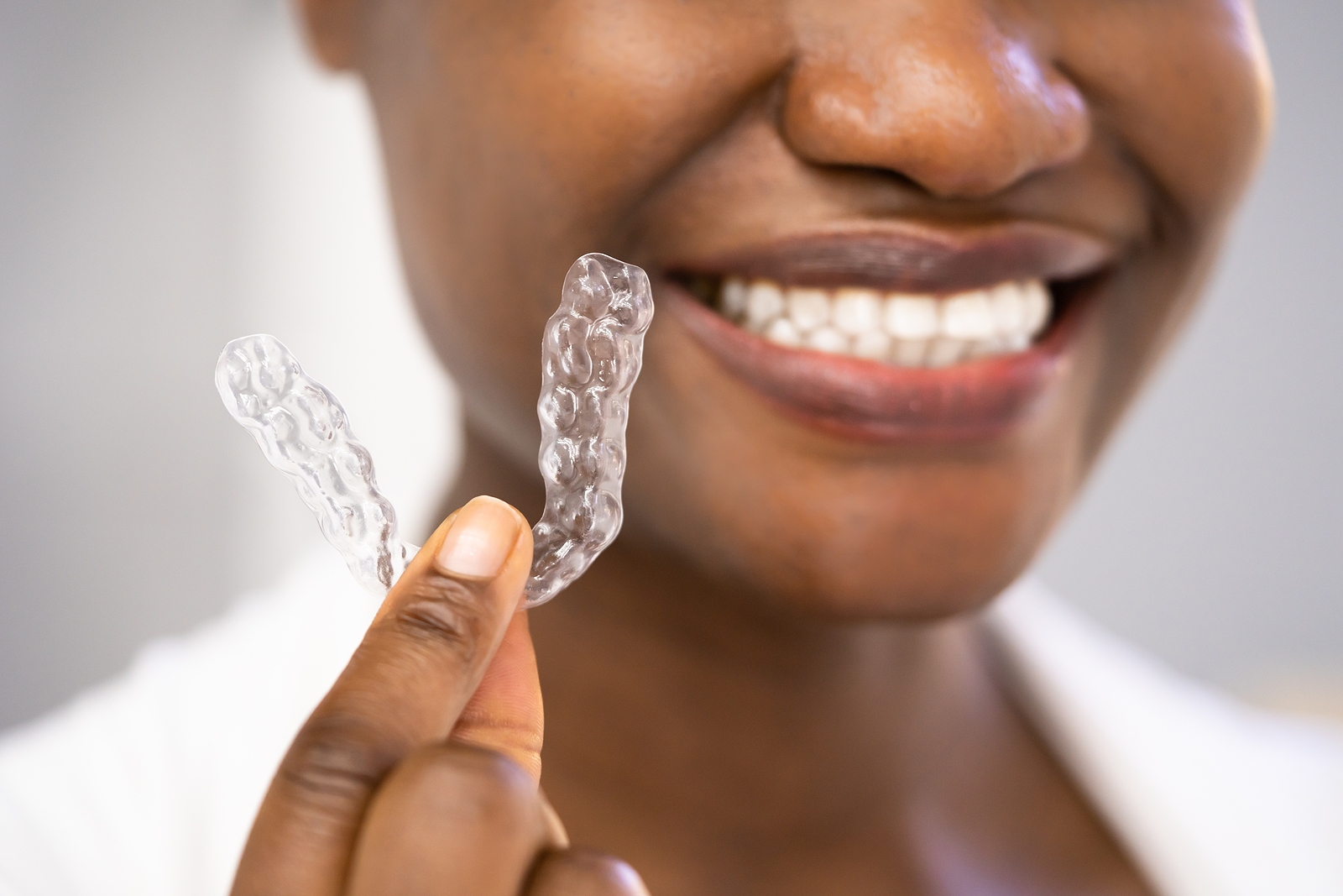 The Clear Aligner Process: What to Expect From Start to Finish