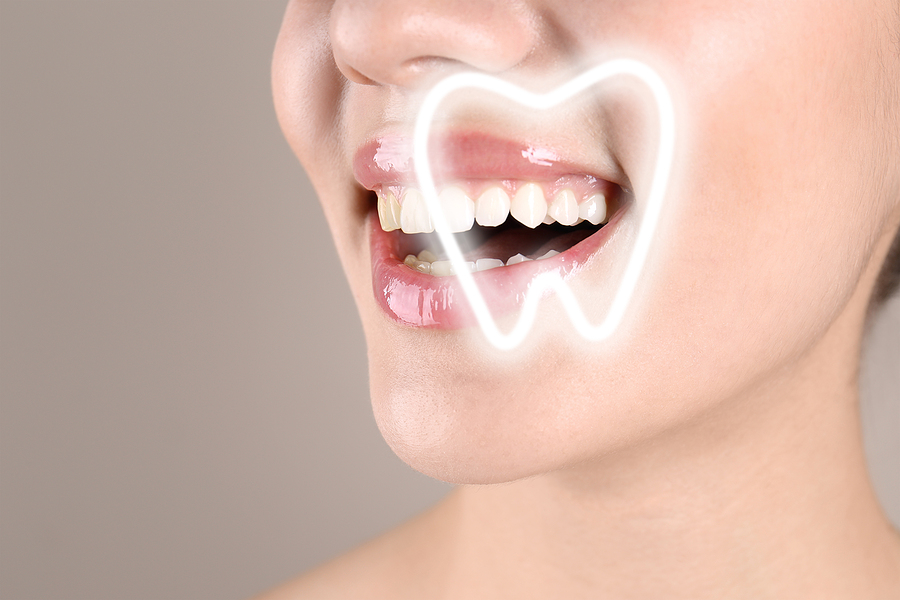 Achieve a Radiant Smile with Professional Teeth Whitening in Stamford, CT