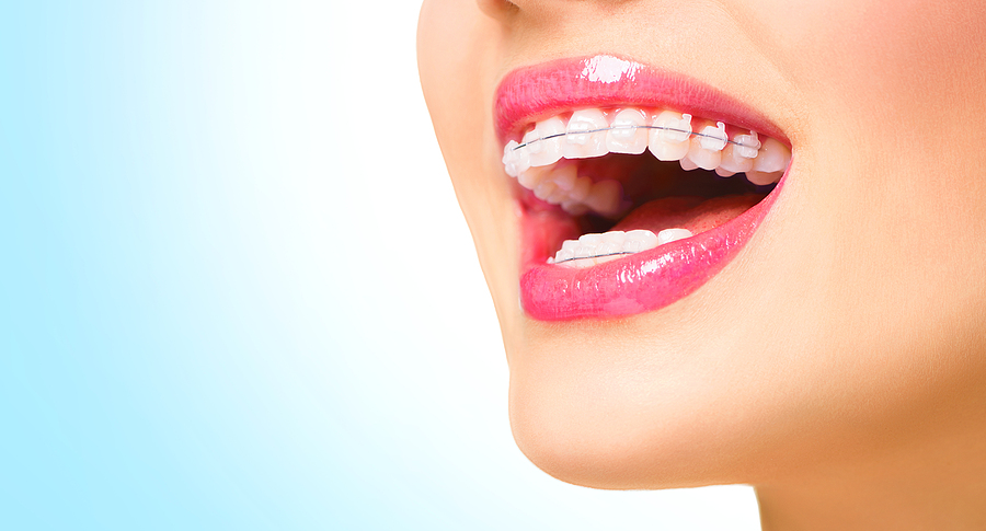 The Science Behind Teeth Whitening: How It Works